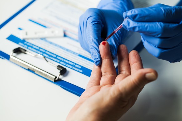 Le test sérologique ne traque pas le virus mais les anticorps. Il a besoin de sang pour donner un résultat