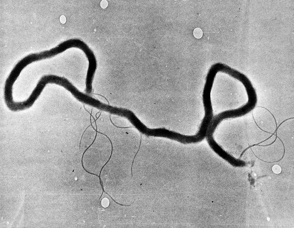 FILE - In this May 23, 1944 file photo, the organism treponema pallidum, which causes syphilis, is seen through an electron microscope. Las Vegas is experiencing a syphilis outbreak, as health officia ...