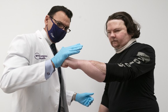 Dr. Eduardo Rodriguez has Joe DiMeo demonstrate the flexibility and strength in his hands, Monday, Jan. 25, 2021 at NYU Langone Health in New York, six months after an extremely rare double hand and f ...