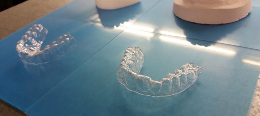 Diese Zahnspange wurde mit einem 3D-Drucker hergestellt.