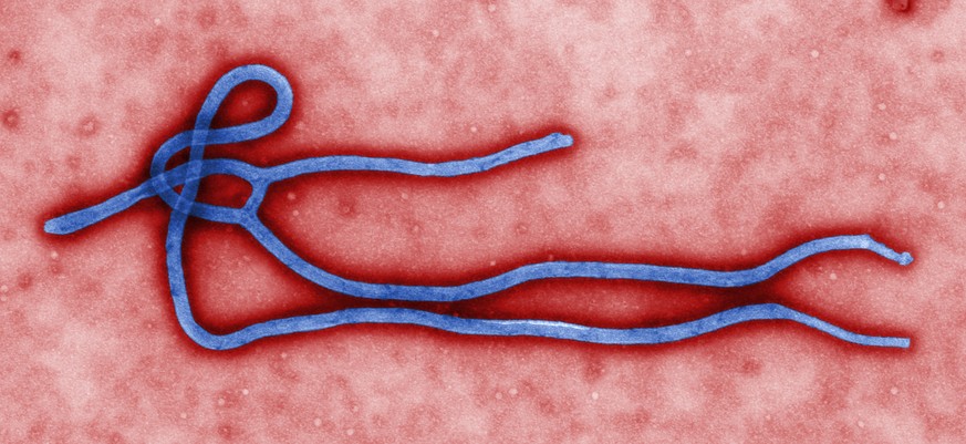 FILE - This undated file image made available by the Centers for Disease Control (CDC) shows the Ebola virus. In a second, smaller Ebola outbreak, at least 69 people, including eight health workers, a ...