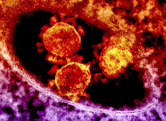 Particles of the Middle East respiratory syndrome (MERS) coronavirus that emerged in 2012 are seen in an undated colorized transmission electron micrograph from the National Institute for Allergy and  ...