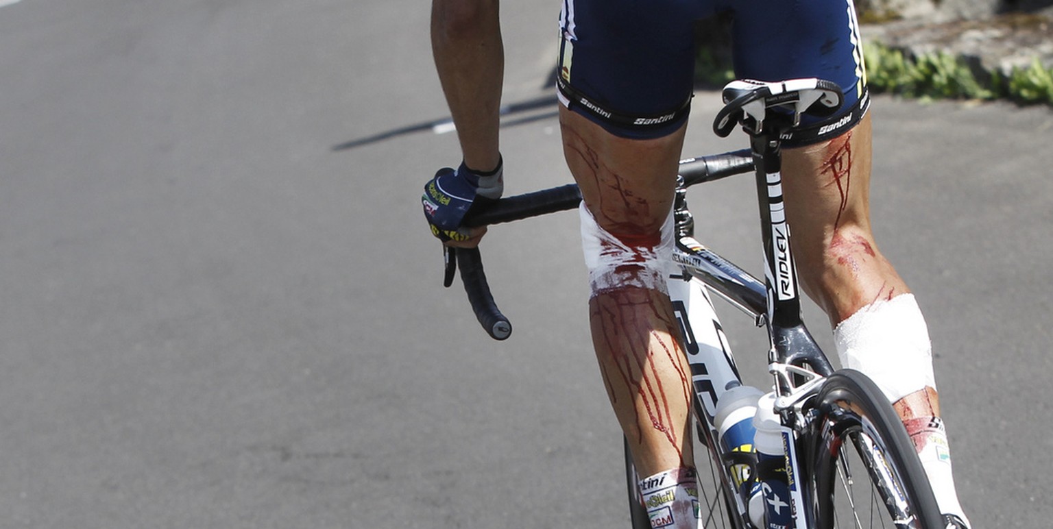 Injuries from barbed wire are seen on the legs of Johnny Hoogerland of The Netherlands as he rides towards Saint Flour during the 9th stage of the Tour de France cycling race over 208 kilometers (129  ...