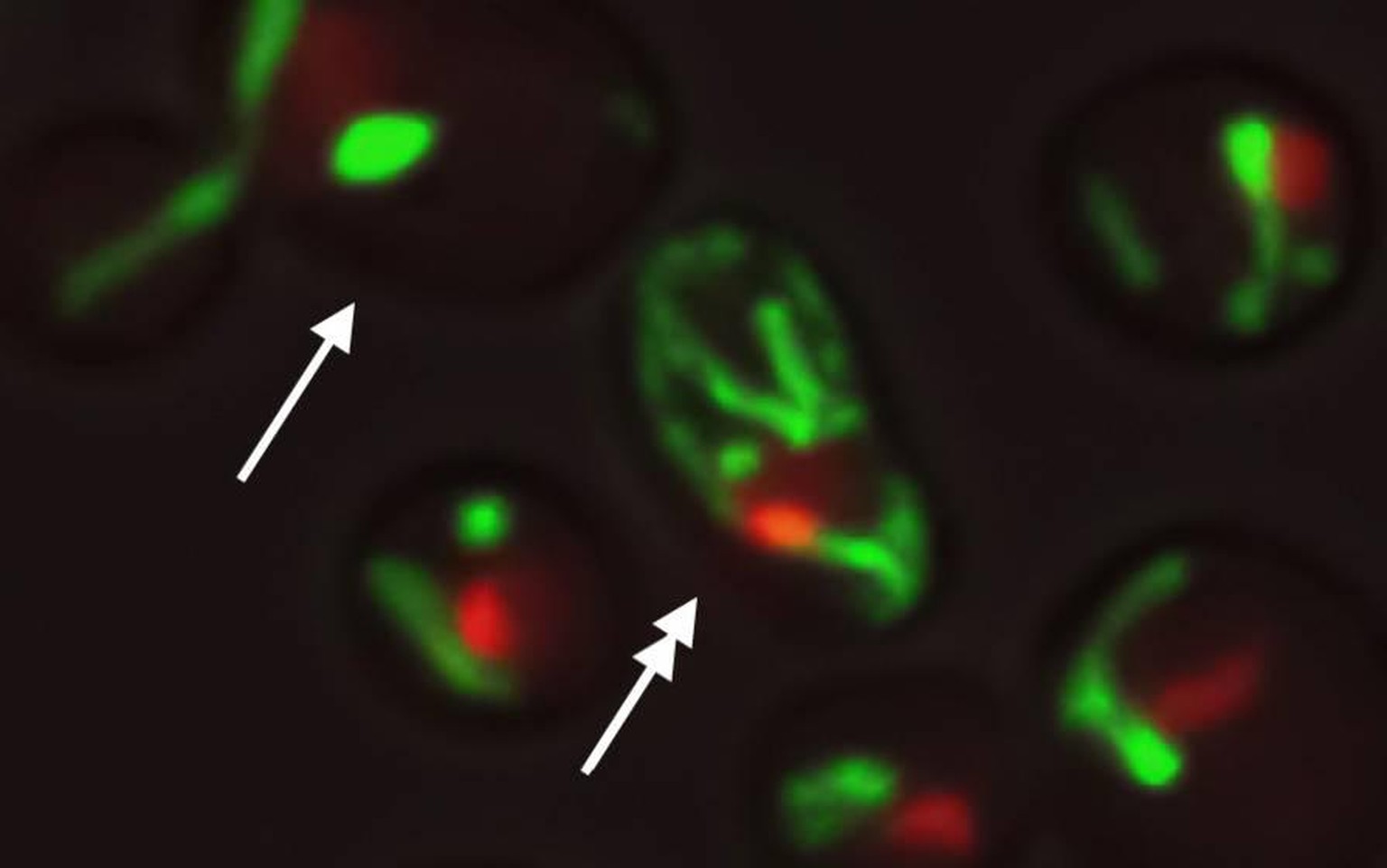 Yeast cells with the same DNA under the same environment show different structures of mitochondria (green) and the nucleolus (red), which may underlie the causes of different aging paths. Single and d ...