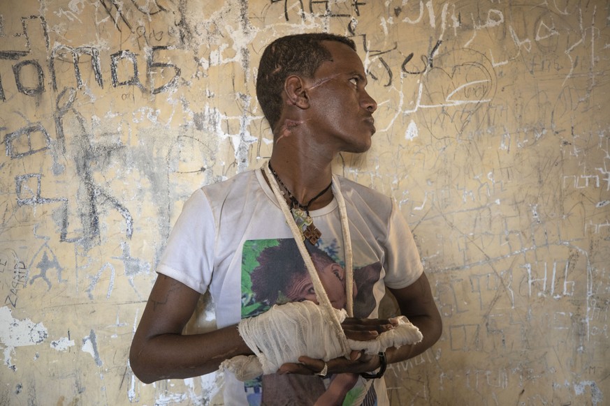 Ethnic Tigrayan survivor Abrahaley Minasbo, 22, from Mai-Kadra, Ethiopia, shows his wounds from machetes in a shelter in the Hamdeyat Transition Center in eastern Sudan, near the Sudan-Ethiopia border ...