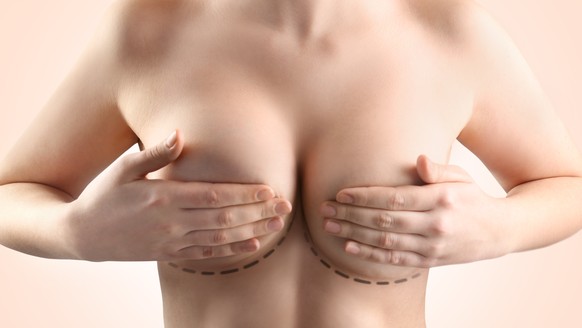 Brust operation silikon
