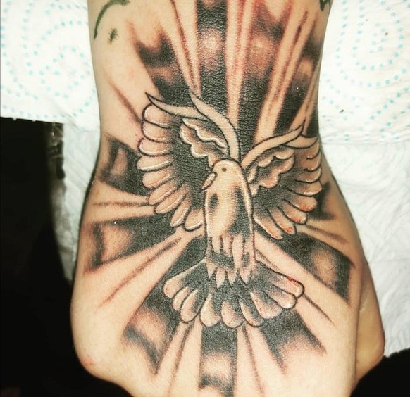 Ist ja zum GlĂŒck nur auf der Hand, fĂ€llt nicht so auf.