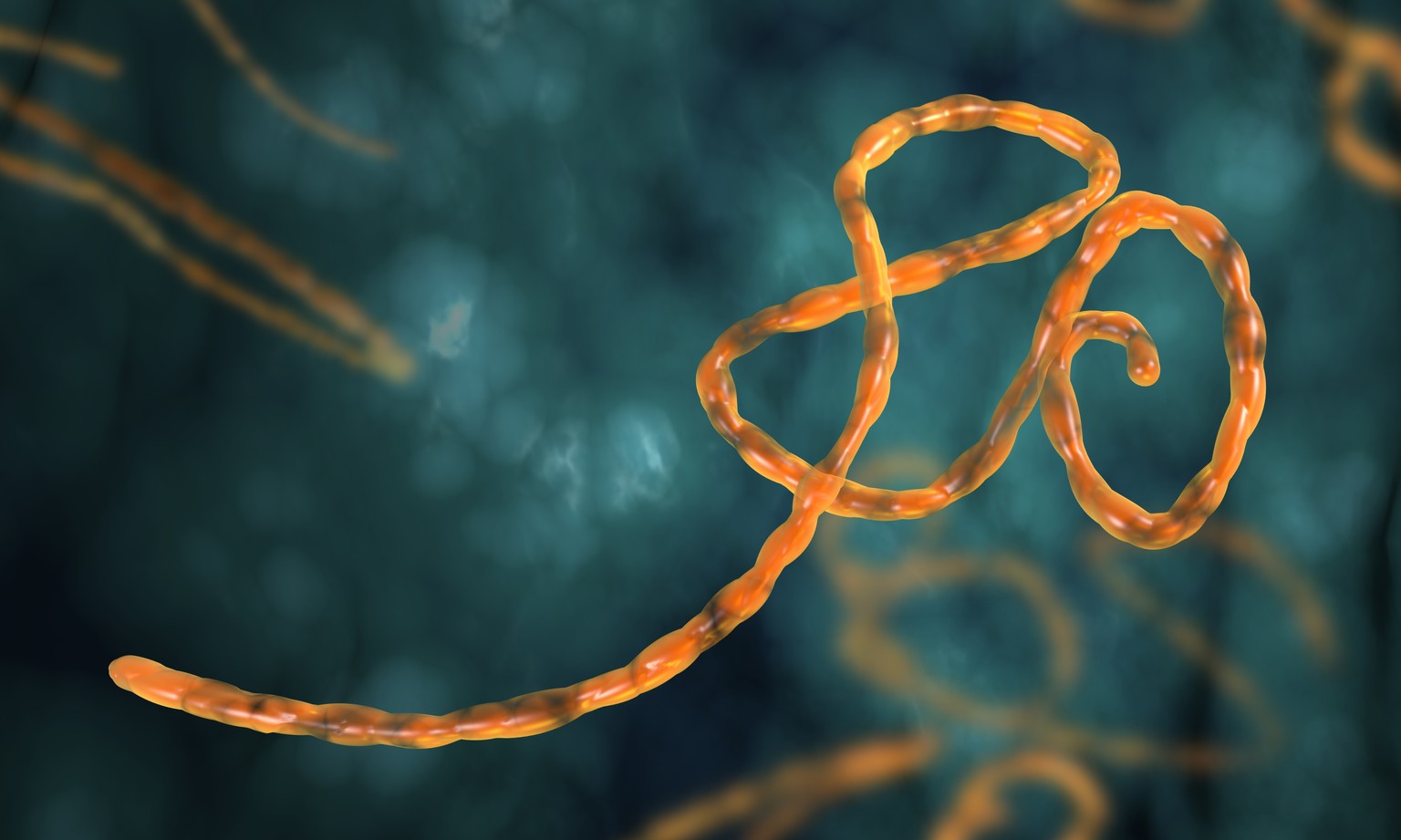 Das Ebola-Virus.