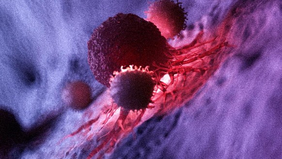 3d rendered medically accurate illustration of white blood cells attacking a cancer cell