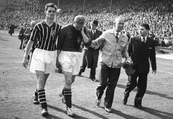 5th May 1956: FA Cup Final: Birmingham City v Manchester City. After helping Manchester City win the Cup 3-1 Bert Trautmann, injured during the match, is helped off the field rubbing his &#039;sore&#0 ...
