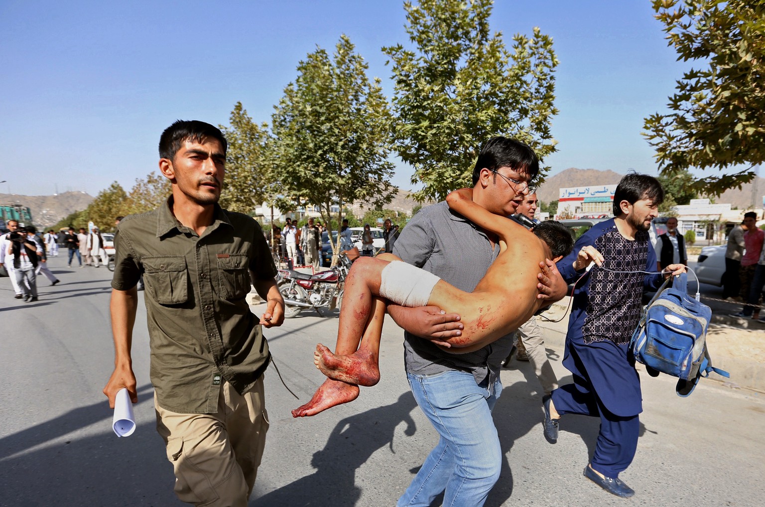 An injured boy is carried to a hospital after an explosion struck a protest in Kabul, Afghanistan, Saturday, July 23, 2016. Witnesses in Kabul say that an explosion struck the protest march by members ...