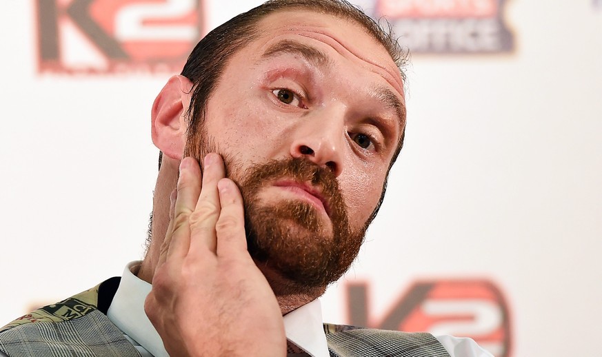 epa05568180 (FILE) A file photograph showing British heavyweight boxer Tyson Fury reacts during a press conference in London, Britain, 23 September 2015. Media reports on 03 October 2016 state that Wo ...