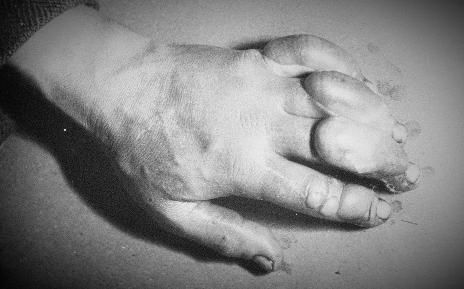 «Atkinsons Hand ist heute furchtbar schlimm, die Finger mit den Frostbeulen sehen aus wie Würste», schreibt Scott am 5. Juli 1911.