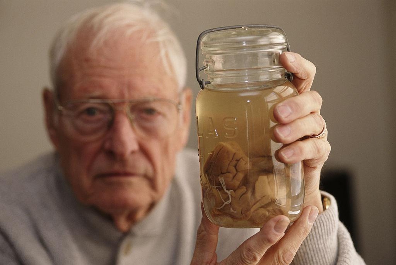 Pathologist Thomas Harvey (1912 - 2007) holds the brain of theoretical physicist Albert Einstein in a jar, Kansas, 1994. Harvey performed the autopsy on Einstein in 1955, and retained parts of the bra ...