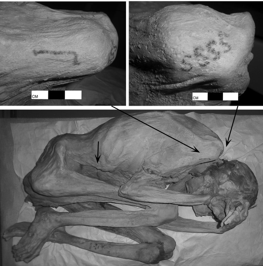 Tattoos auf ägyptischen Mumien der prädynastischen Zeit, Gebelein-Mann-A