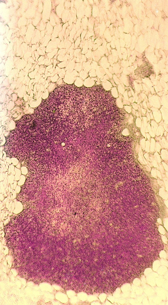 Thymus: Retrosternaler Fettkörper: Reste von Thymusgewebe, umgeben von Fettzellen (Mensch, HOPA-Färbung, Objektiv 56x)
Von Gleiberg - selbst fotografiert, CC-by-sa 2.0/de, https://de.wikipedia.org/w/i ...
