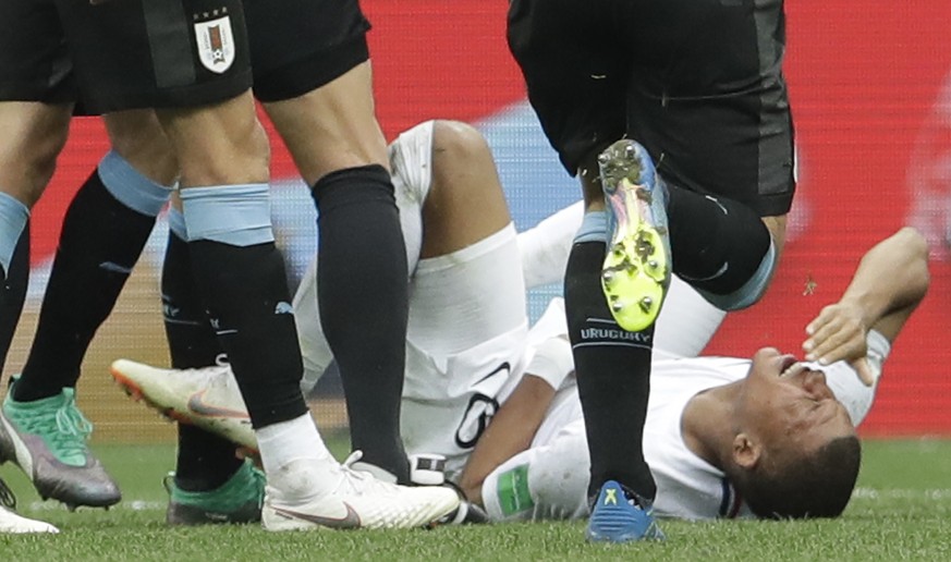 France&#039;s Kylian Mbappe, right, lies on the pitch during the quarterfinal match between Uruguay and France at the 2018 soccer World Cup in the Nizhny Novgorod Stadium, in Nizhny Novgorod, Russia,  ...