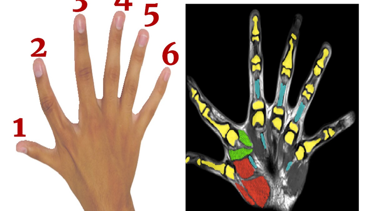 Kurioses Diese Studie Zeigt Wieso Sechs Finger Besser Sind Als Funf Watson