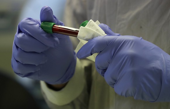 A blood sample from a volunteer is handled in the laboratory at Imperial College in London, Thursday, July 30, 2020. Imperial College is working on the development of a COVID-19 vaccine. Scientists at ...