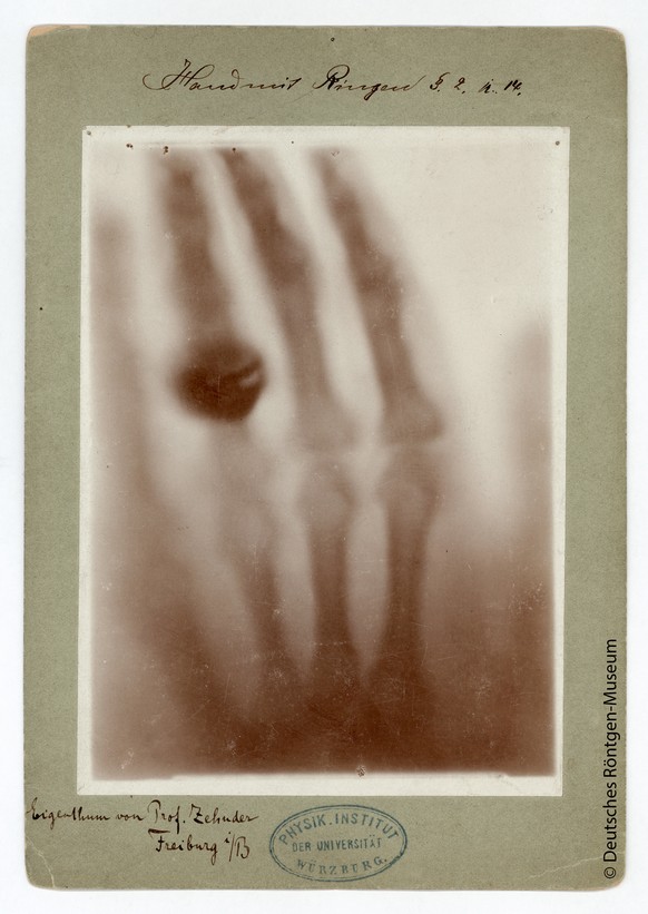 HANDOUT - Die Hand von Anna Bertha Roentgen mit Fingerring in einer Roentgen-Aufnahme vom 22. Dezember 1895 durch Conrad Wilhelm Roentgen in Wuerzburg. So zeigt das Bild ihre Handknochen mit dem Finge ...