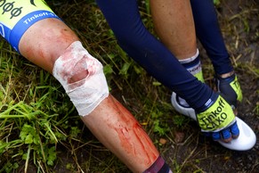 Contadors Verletzung am Schienbein.