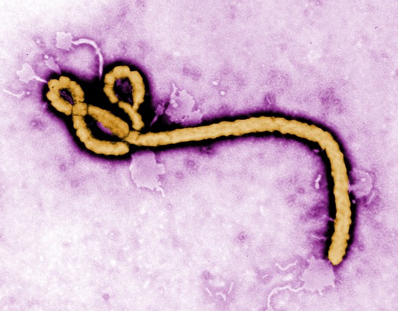 Löst tödliche Blutungen aus: Ebola-Virus.