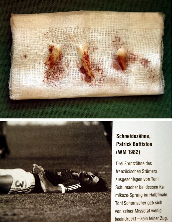 The teeth of French player Patrick Battiston lost when he clashed with German goalkeeper Toni Schumacher in the World Cup 1982 semi final are exhibited in the gallery &#039;The Aquarium&#039; in Berli ...