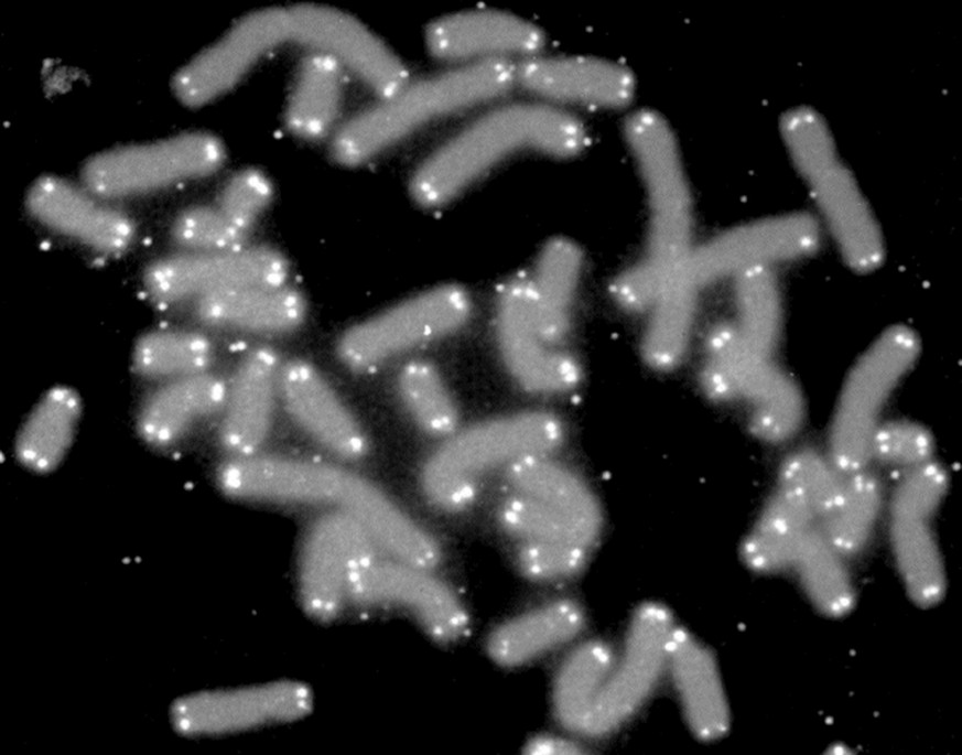 Menschliche Chromosomen (grau) mit markierten Telomeren an den Enden (weiss).
https://de.wikipedia.org/wiki/Telomer#/media/Datei:Telomere_caps.gif