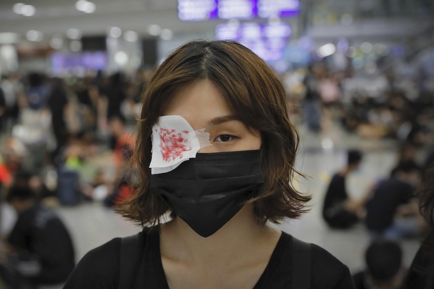 A protester wears an eyepatch during a sit-in protest at the Hong Kong International Airport in Hong Kong, Monday, Aug. 12, 2019. One of the world&#039;s busiest airports canceled all flights after th ...