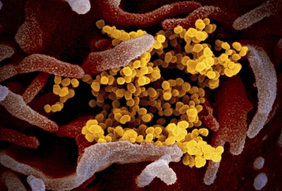 FILE - This undated electron microscope image made available by the U.S. National Institutes of Health in February 2020 shows the Novel Coronavirus SARS-CoV-2, yellow, emerging from the surface of cel ...