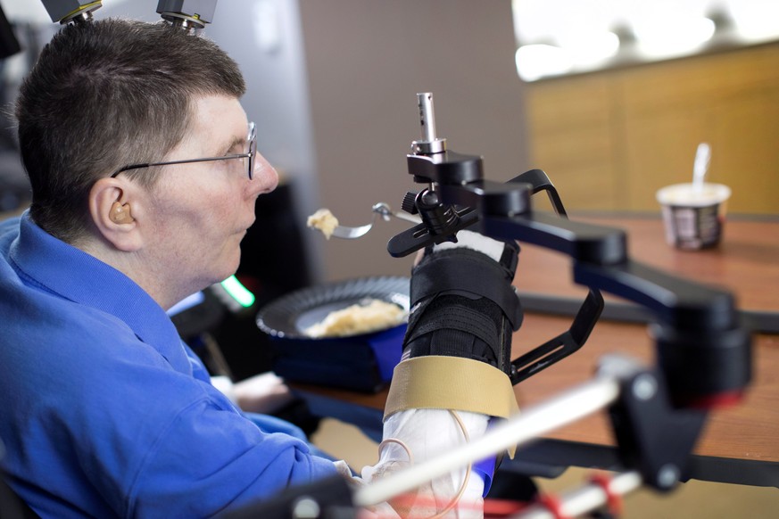 Bill Kochevar, 56, is using computer-brain interface technology and an electrical stimulation system to move his own arm after eight years of paralysis, in this undated handout photo. Case Western Res ...