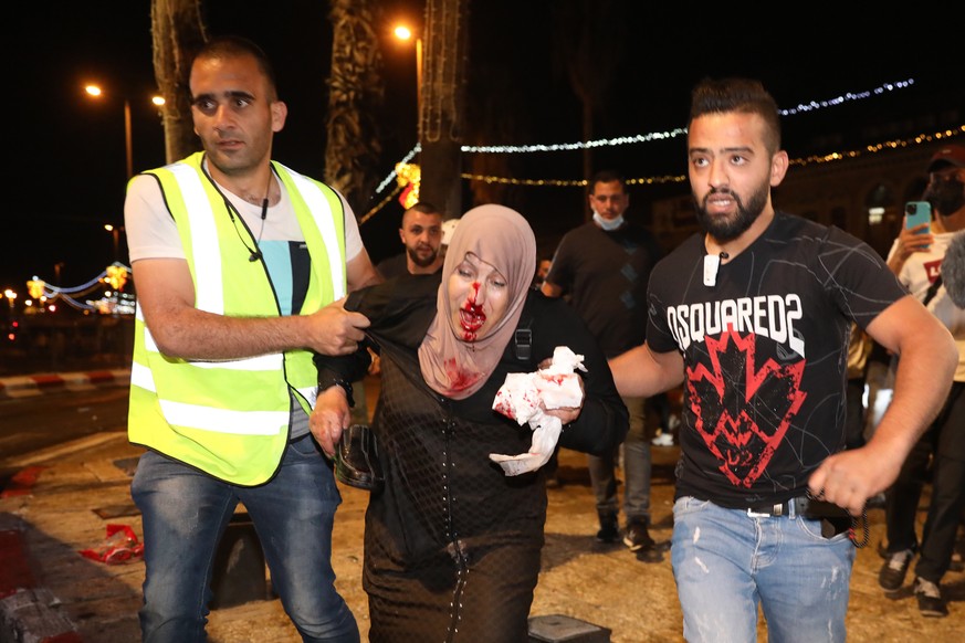 epaselect epa09186522 People help an injured Palestinian woman during a protest in Damascus gate supporting Palestinian families that face eviction from their homes at Sheikh Jarrah neighborhood, in J ...