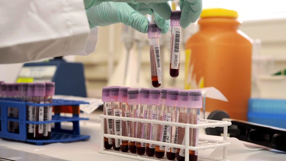epa02669763 (FILE) A file picture dated 10 June 2008 shows a laboratory assistant preparing blood to be tested for growth hormone and blood transfusion at the Swiss Laboratory for Analysis of Doping ( ...